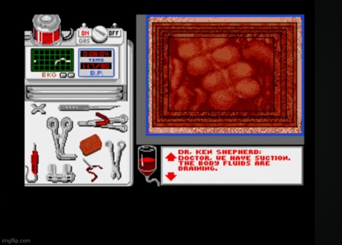 Life and Death Amiga surgery | image tagged in life and death amiga surgery | made w/ Imgflip meme maker