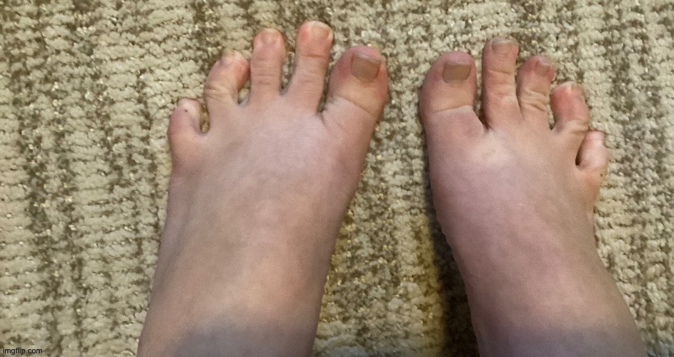 IcyXD FEET!!! v2 | image tagged in icyxd feet v2 | made w/ Imgflip meme maker