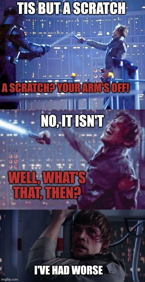 Tis but a scratch | image tagged in luke's arm is off | made w/ Imgflip meme maker