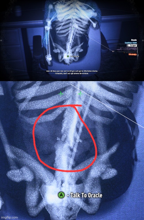 Fun fact, if you look at Barbara's skeleton in Detective Mode, you can see her broken spine from when Joker shot her years ago. | made w/ Imgflip meme maker