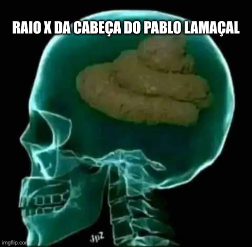 Pablo Marçal prefeito são paulo | RAIO X DA CABEÇA DO PABLO LAMAÇAL | image tagged in prefeito,sao paulo,2024,eleicoes | made w/ Imgflip meme maker