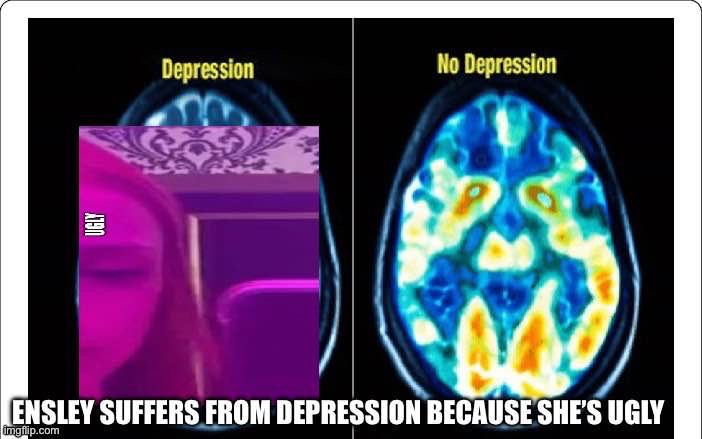 3nsley Is Ugly And Has Depression | image tagged in ugly,depression,depressed,ugly woman,ugly face | made w/ Imgflip meme maker