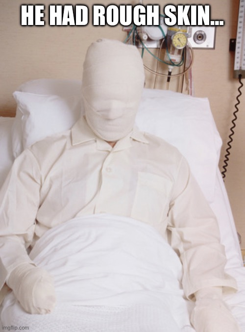 HE HAD ROUGH SKIN… | image tagged in mummy man in bed | made w/ Imgflip meme maker