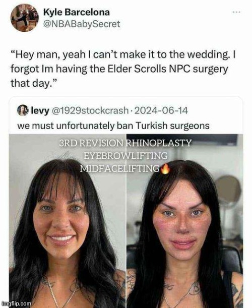 Elder Scrolls Surgery | image tagged in memes,rareinsults,reddit | made w/ Imgflip meme maker