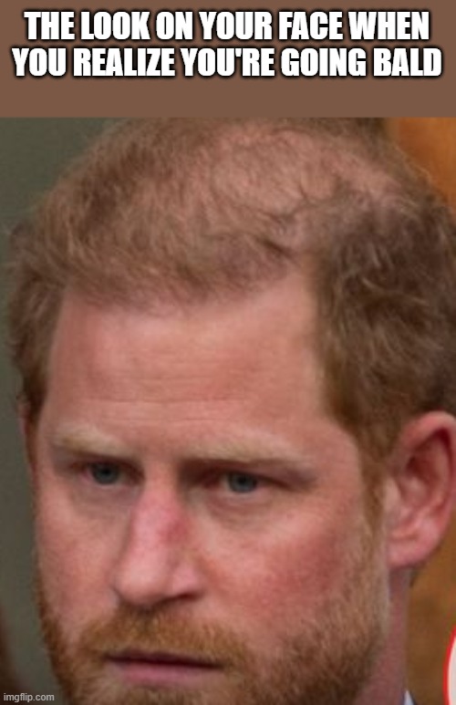 Prince Harry Going Bald | THE LOOK ON YOUR FACE WHEN YOU REALIZE YOU'RE GOING BALD | image tagged in prince harry,bald,balding,hair,funny,memes | made w/ Imgflip meme maker