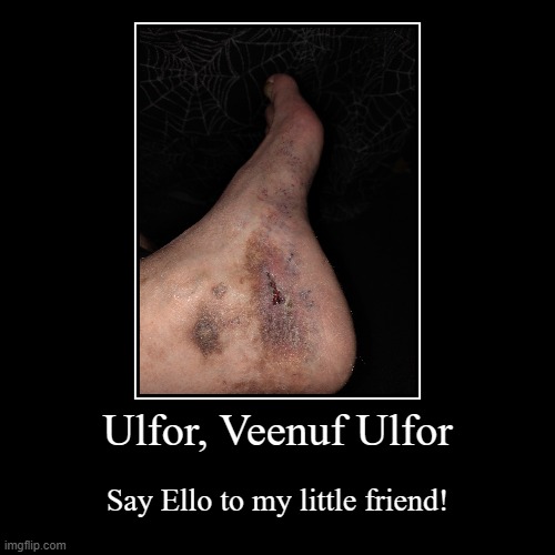 Venus Ulcer | Ulfor, Veenuf Ulfor | Say Ello to my little friend! | image tagged in funny,demotivationals,factor5,venusulcers,safetyfirst,nolihocdomi | made w/ Imgflip demotivational maker