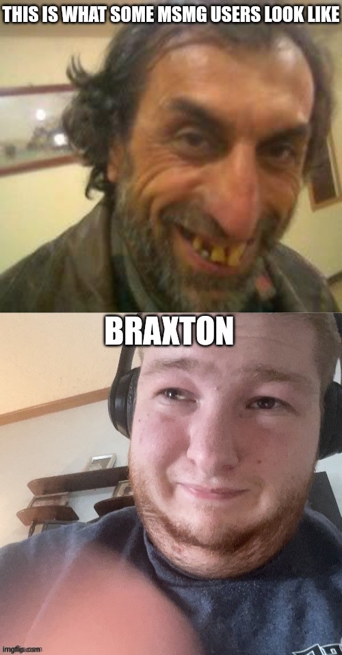 THIS IS WHAT SOME MSMG USERS LOOK LIKE; BRAXTON | image tagged in ugly guy,braxtoncummings face reveal | made w/ Imgflip meme maker