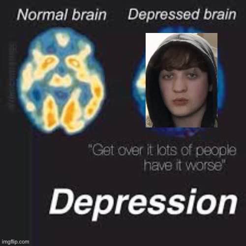 Noah jones has depression because he’s ugly | image tagged in depression,wales,ugly guy,incel,virgin,loser | made w/ Imgflip meme maker