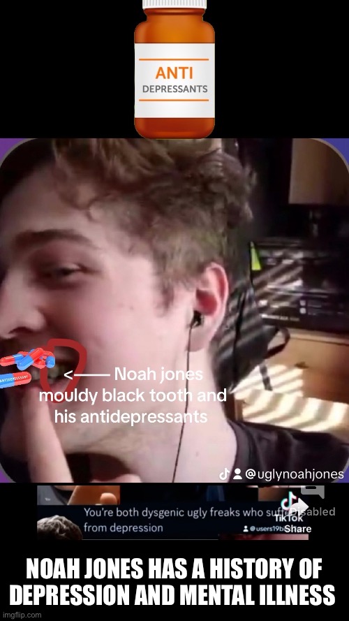 Noah jones takes antidepressants and is ugly | NOAH JONES HAS A HISTORY OF DEPRESSION AND MENTAL ILLNESS | image tagged in depression,ugly guy,ugly face,be careful who you call ugly in middle school | made w/ Imgflip meme maker