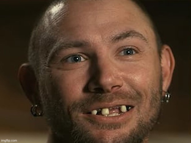 3 teeth guy | image tagged in 3 teeth guy | made w/ Imgflip meme maker
