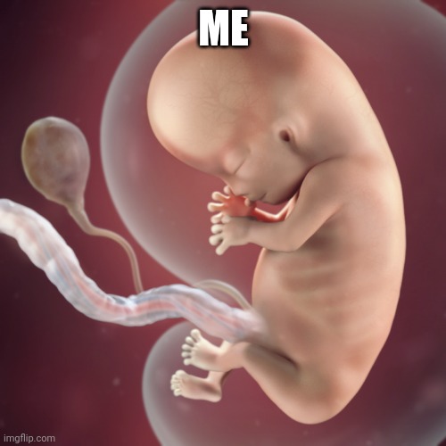 10 Week Fetus | ME | image tagged in 10 week fetus | made w/ Imgflip meme maker