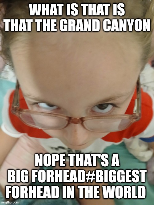 Big forhead | WHAT IS THAT IS THAT THE GRAND CANYON; NOPE THAT'S A BIG FORHEAD#BIGGEST FORHEAD IN THE WORLD | image tagged in big forhead | made w/ Imgflip meme maker