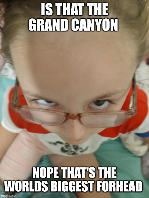 Big forhead | IS THAT THE GRAND CANYON; NOPE THAT'S THE WORLDS BIGGEST FORHEAD | image tagged in big forhead | made w/ Imgflip meme maker