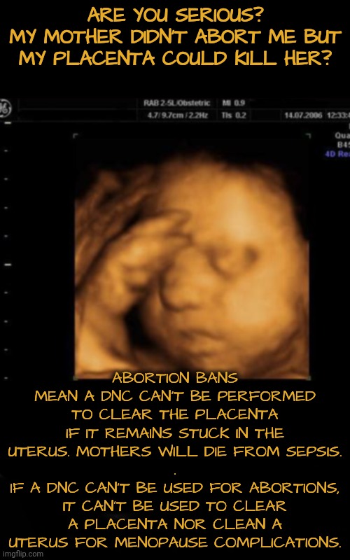 DNC Procedures are Used For Several Healthcare Issues: not just for abortion | ARE YOU SERIOUS?
MY MOTHER DIDN'T ABORT ME BUT MY PLACENTA COULD KILL HER? ABORTION BANS MEAN A DNC CAN'T BE PERFORMED TO CLEAR THE PLACENTA IF IT REMAINS STUCK IN THE UTERUS. MOTHERS WILL DIE FROM SEPSIS.
.
IF A DNC CAN'T BE USED FOR ABORTIONS, IT CAN'T BE USED TO CLEAR A PLACENTA NOR CLEAN A UTERUS FOR MENOPAUSE COMPLICATIONS. | image tagged in menopause,healthcare,dnc,msnbc,abortion,womens rights | made w/ Imgflip meme maker