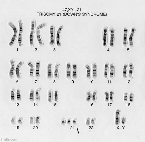 @lapetus I found your karyotype | made w/ Imgflip meme maker