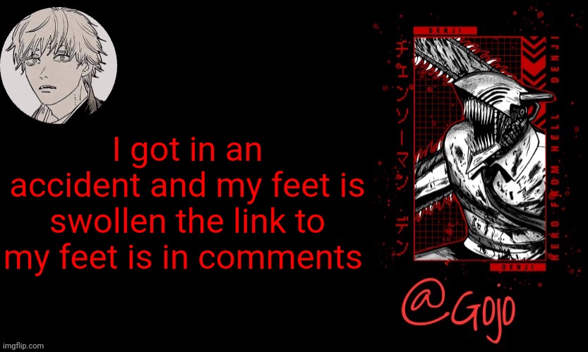 What should I do | I got in an accident and my feet is swollen the link to my feet is in comments | image tagged in gojo announcement template v6 | made w/ Imgflip meme maker