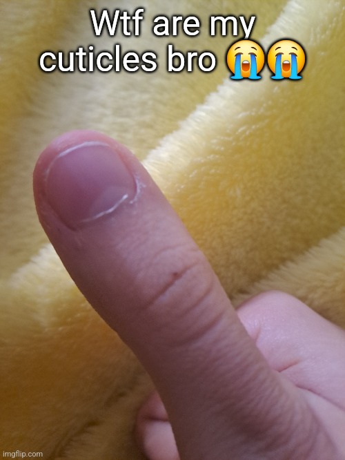 I rip them off too often ig | Wtf are my cuticles bro 😭😭 | made w/ Imgflip meme maker