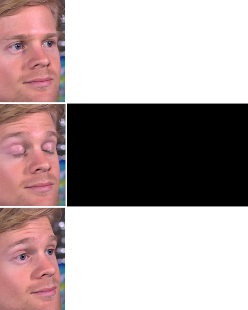 blinking guy vertical blank face Blank Meme Template