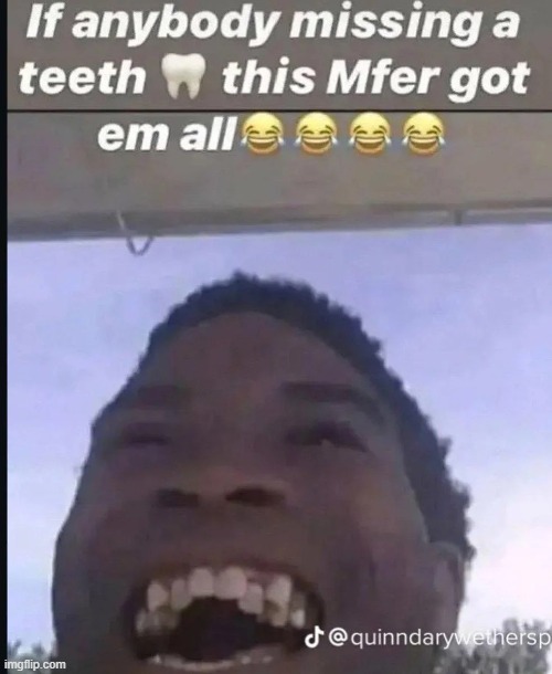 He could use some braces. | image tagged in teeth | made w/ Imgflip meme maker