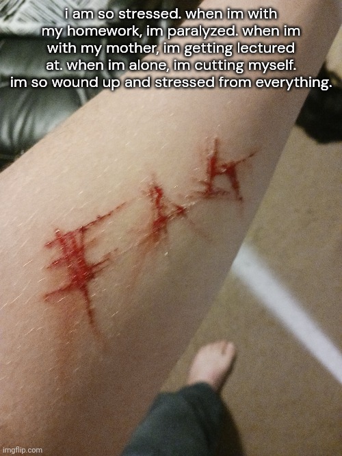TW: SELF HARM, STRESS, BLOOD AND A SMALL WOUND | i am so stressed. when im with my homework, im paralyzed. when im with my mother, im getting lectured at. when im alone, im cutting myself. im so wound up and stressed from everything. | made w/ Imgflip meme maker