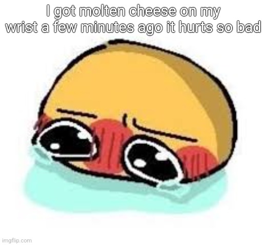 amb shamb bbbmba | I got molten cheese on my wrist a few minutes ago it hurts so bad | image tagged in amb shamb bbbmba | made w/ Imgflip meme maker