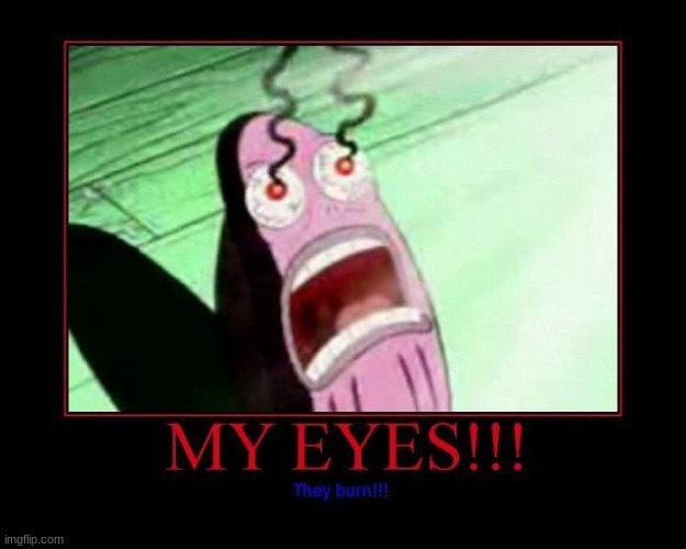 my eyes picture | image tagged in my eyes picture | made w/ Imgflip meme maker