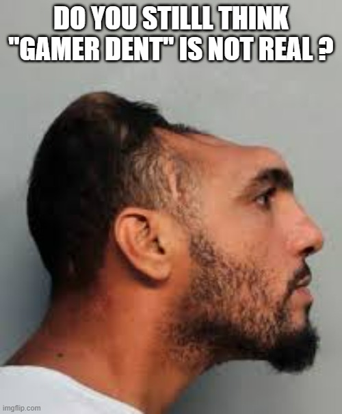 memes by Brad - Gamer dent is real - video games - humor - | DO YOU STILLL THINK "GAMER DENT" IS NOT REAL ? | image tagged in gaming,video games,funny,computer games,head,humor | made w/ Imgflip meme maker