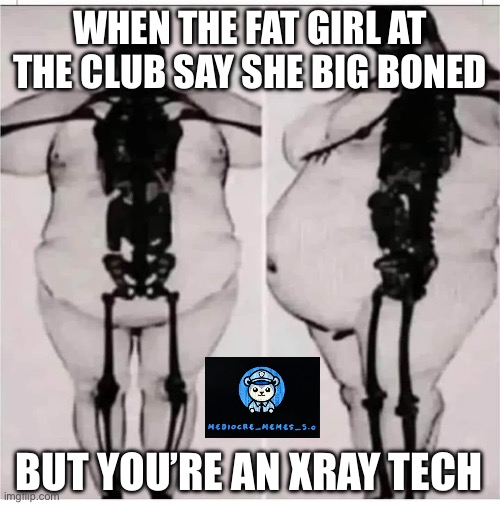 Big boned | WHEN THE FAT GIRL AT THE CLUB SAY SHE BIG BONED; BUT YOU’RE AN XRAY TECH | image tagged in fatty,funny memes | made w/ Imgflip meme maker