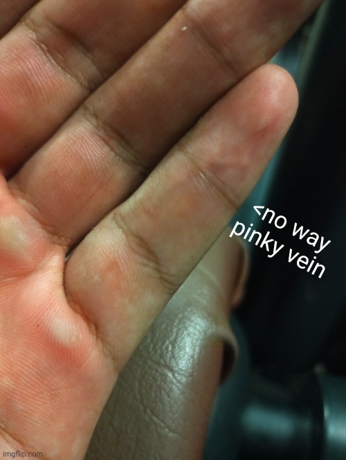 an noticeable one as well | <no way pinky vein | made w/ Imgflip meme maker