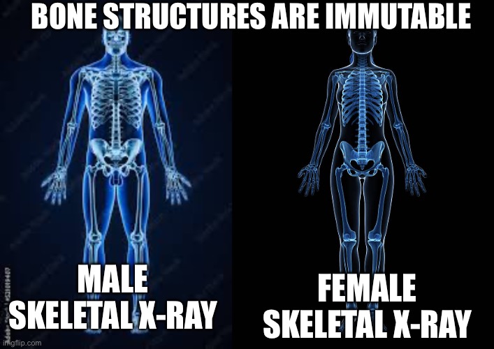 To truly be “Trans” the whole anatomy has to change. Including bones and DNA. | BONE STRUCTURES ARE IMMUTABLE; FEMALE SKELETAL X-RAY; MALE SKELETAL X-RAY | image tagged in x-ray | made w/ Imgflip meme maker