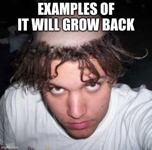 bad haircut | EXAMPLES OF IT WILL GROW BACK | image tagged in bad haircut | made w/ Imgflip meme maker