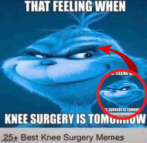 chat is this real? | image tagged in knee surgery | made w/ Imgflip meme maker