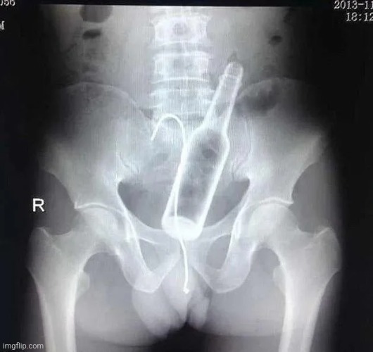 X-ray came back, I didn't break a single bone | made w/ Imgflip meme maker