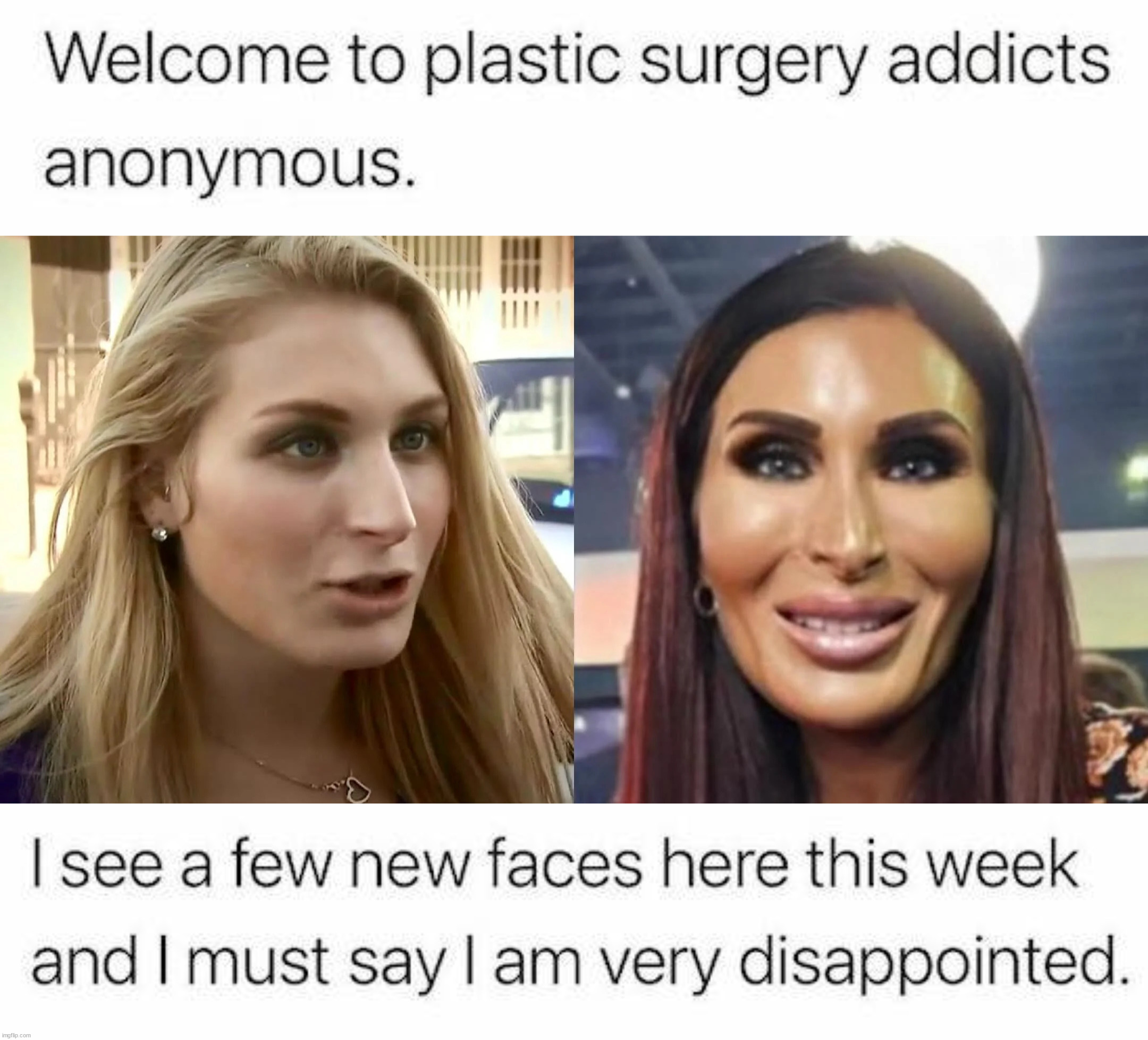 New faces | image tagged in laura loomer before and after plastic surgery | made w/ Imgflip meme maker