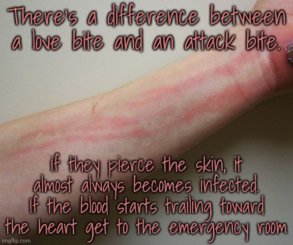 There's a difference between a love bite and an attack bite. if they pierce the skin, it almost always becomes infected. If the blood starts | made w/ Imgflip meme maker