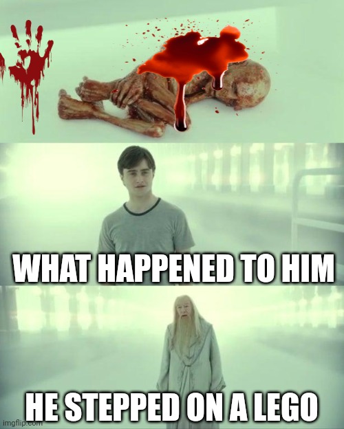 Dead Baby Voldemort / What Happened To Him | WHAT HAPPENED TO HIM; HE STEPPED ON A LEGO | image tagged in dead baby voldemort / what happened to him | made w/ Imgflip meme maker