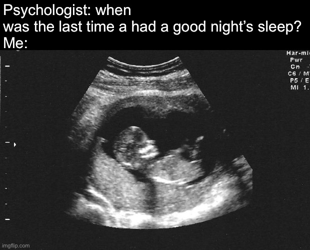 Ahhh, the pleasant memories | Psychologist: when was the last time a had a good night’s sleep?
Me: | image tagged in ultrasound babby,remember,sleep,psychologist | made w/ Imgflip meme maker