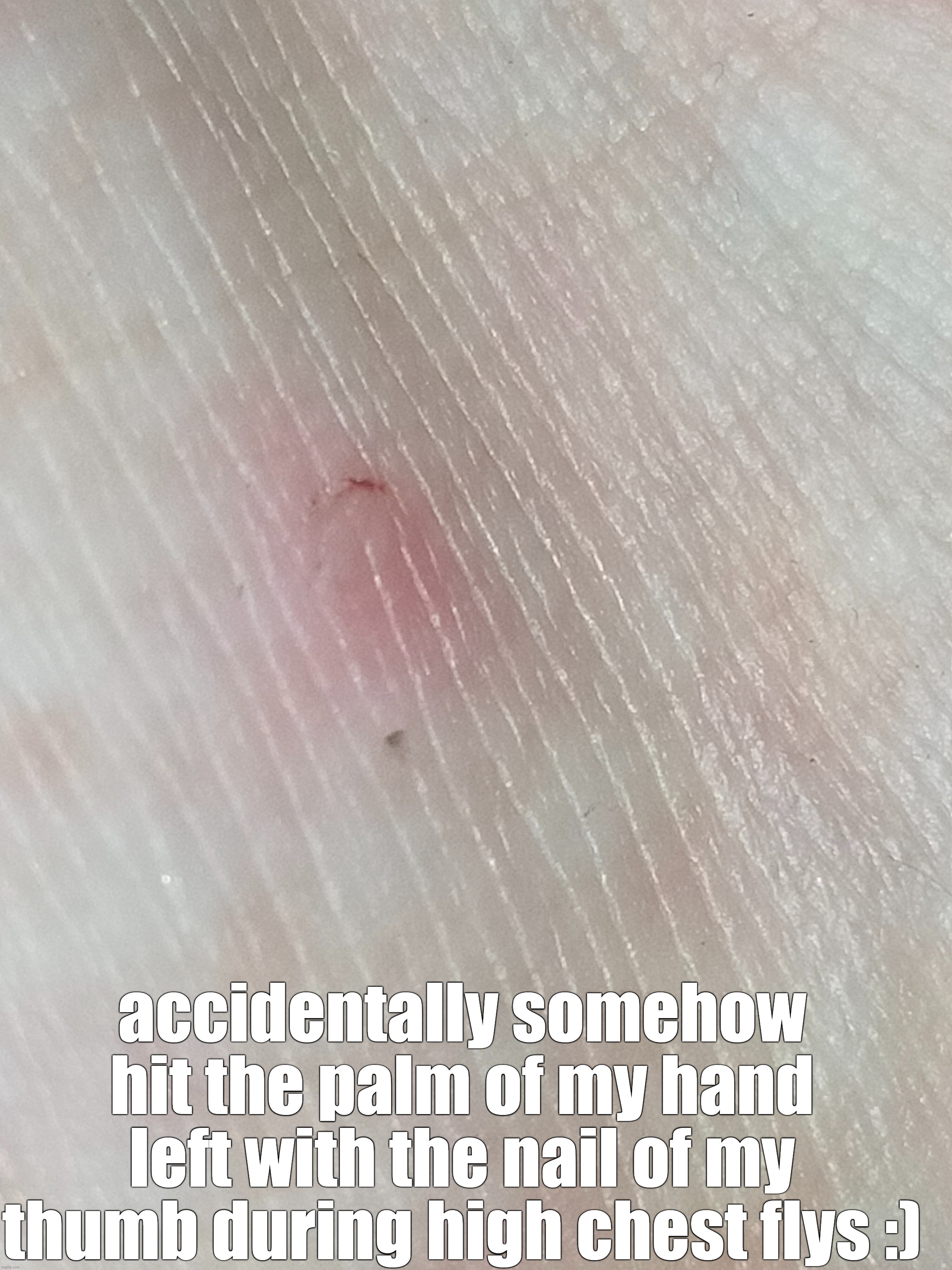 just something silly | accidentally somehow hit the palm of my hand left with the nail of my thumb during high chest flys :) | made w/ Imgflip meme maker