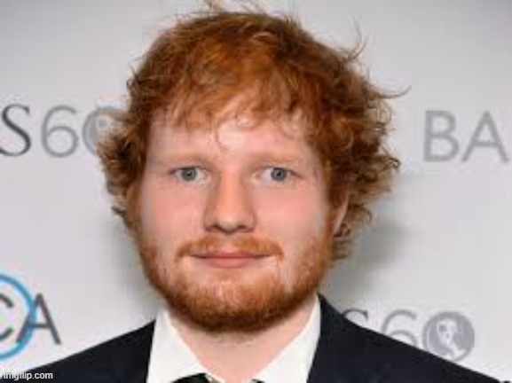 Derpy Ed Sheeran | image tagged in derpy ed sheeran | made w/ Imgflip meme maker