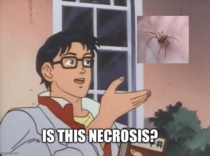 Is this a bird? | IS THIS NECROSIS? | image tagged in is this a bird | made w/ Imgflip meme maker