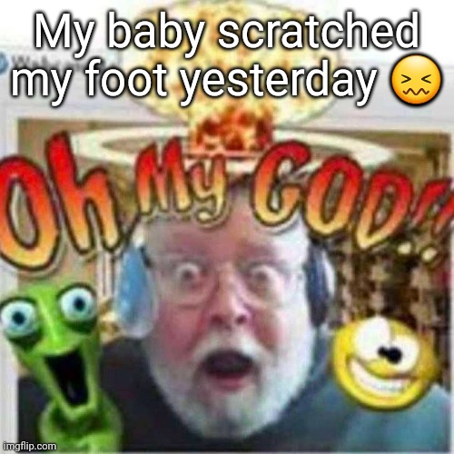 Oh My GOD!! | My baby scratched my foot yesterday 😖 | image tagged in oh my god | made w/ Imgflip meme maker