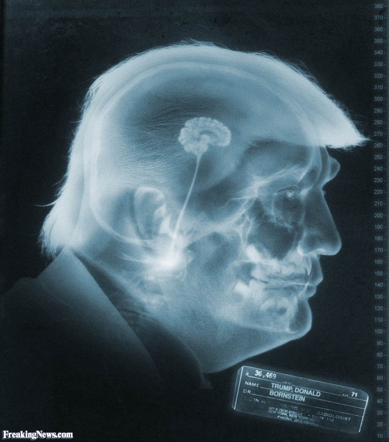Trump brain moron Republican stupid x-ray JPP Blank Meme Template