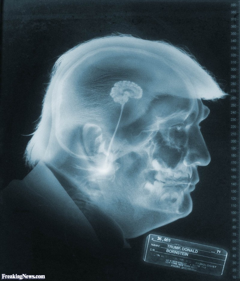 Trump brain moron Republican stupid x-ray JPP Blank Meme Template