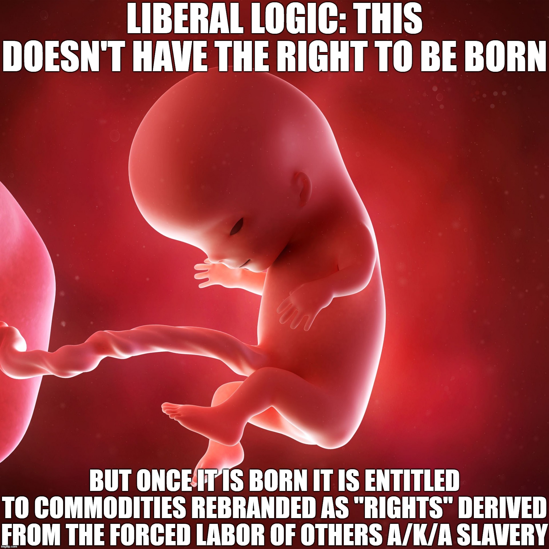 Liberal Logic: Abortion and Birth | LIBERAL LOGIC: THIS DOESN'T HAVE THE RIGHT TO BE BORN; BUT ONCE IT IS BORN IT IS ENTITLED TO COMMODITIES REBRANDED AS "RIGHTS" DERIVED FROM THE FORCED LABOR OF OTHERS A/K/A SLAVERY | image tagged in fetus,abortion,birth,logic,libs do not have it | made w/ Imgflip meme maker