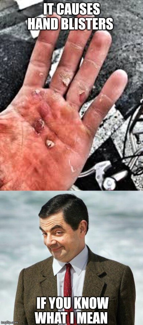 IT CAUSES HAND BLISTERS IF YOU KNOW WHAT I MEAN | image tagged in mr bean | made w/ Imgflip meme maker