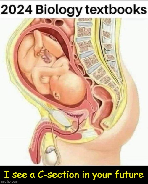 You don't have to be a prophet to predict this one... | I see a C-section in your future | image tagged in liberals vs conservatives,men and women,difference between men and women,know the difference,spot the difference,political humor | made w/ Imgflip meme maker