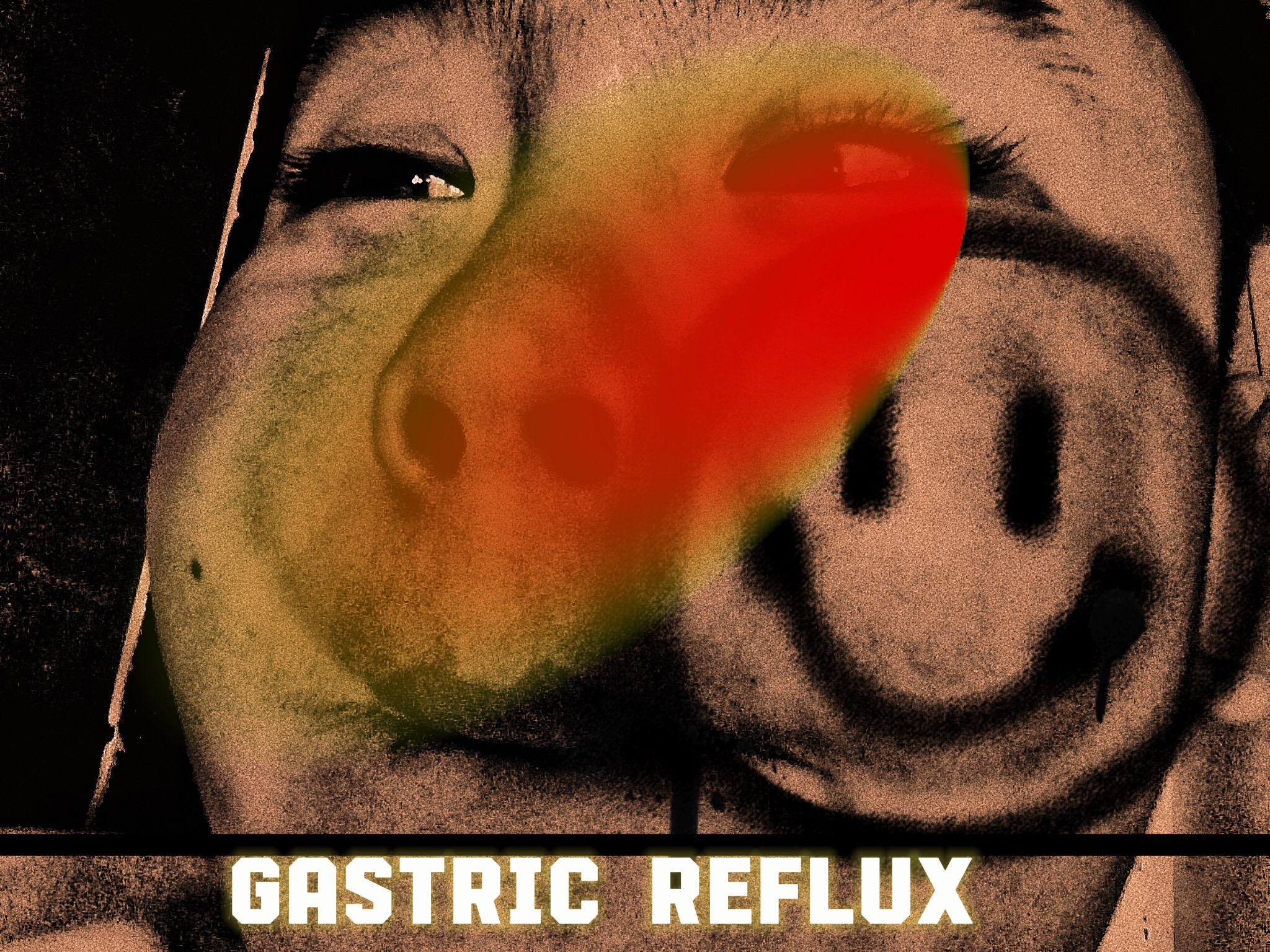 High Quality Gastric reflux Blank Meme Template