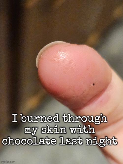 I burned through my skin with chocolate last night | made w/ Imgflip meme maker