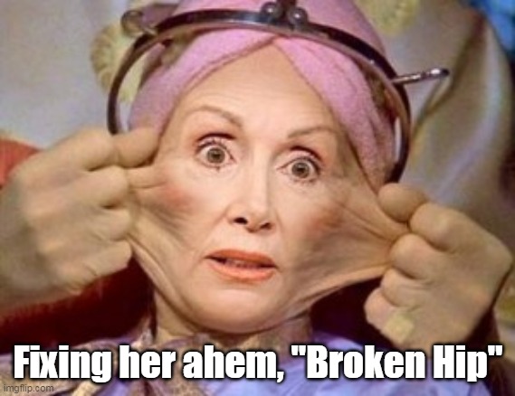 Timing is sure convenient | Fixing her ahem, "Broken Hip" | image tagged in pelosi face lift hip broke meme | made w/ Imgflip meme maker