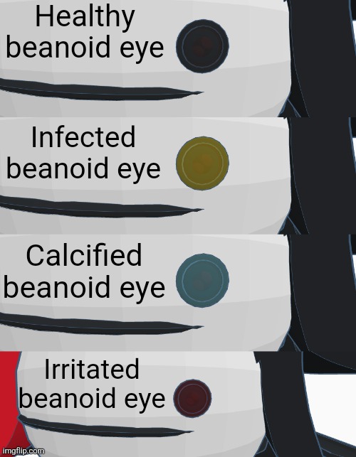 Healthy beanoid eye; Infected beanoid eye; Calcified beanoid eye; Irritated beanoid eye | made w/ Imgflip meme maker